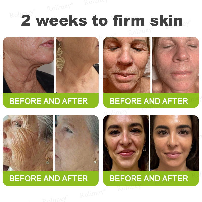 💧Made and shipped from the IE🧑‍⚕️💫Rolimey® Botox & Vita-A Retinol Shot Wrinkle-Lift Tightening cream - Last Day Promotion 70% OFF