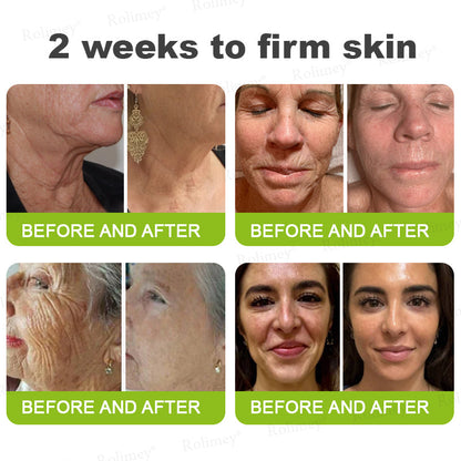 💧Made and shipped from the IE🧑‍⚕️💫Rolimey® Botox & Vita-A Retinol Shot Wrinkle-Lift Tightening cream - Last Day Promotion 70% OFF