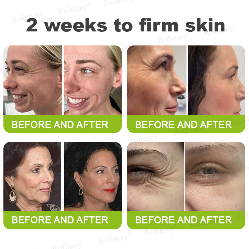 💧Made and shipped from the IE🧑‍⚕️💫Rolimey® Botox & Vita-A Retinol Shot Wrinkle-Lift Tightening cream - Last Day Promotion 70% OFF