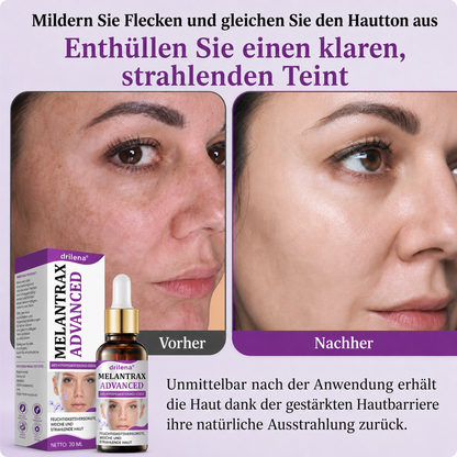 🌸 drilena® MelantraX – Fortschrittliche Anti-Hyperpigmentierungs-Essenz