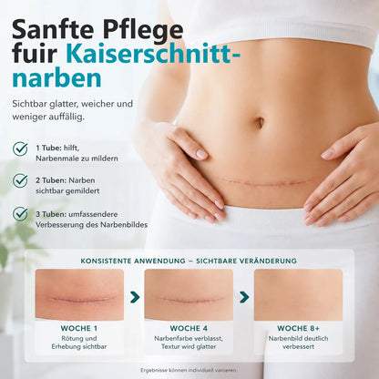 🛒drilena® Reparierende Anti-Narben-Creme — Dehnungsstreifen, Narben & Aknemale