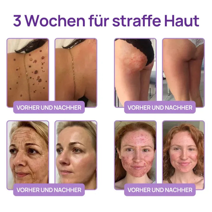 🪄drilena® Straffende Hals- & Dekolleté-Roll-On-Creme