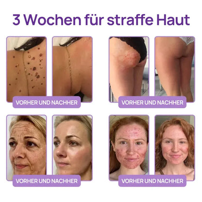 🪄drilena® Straffende Hals- & Dekolleté-Roll-On-Creme