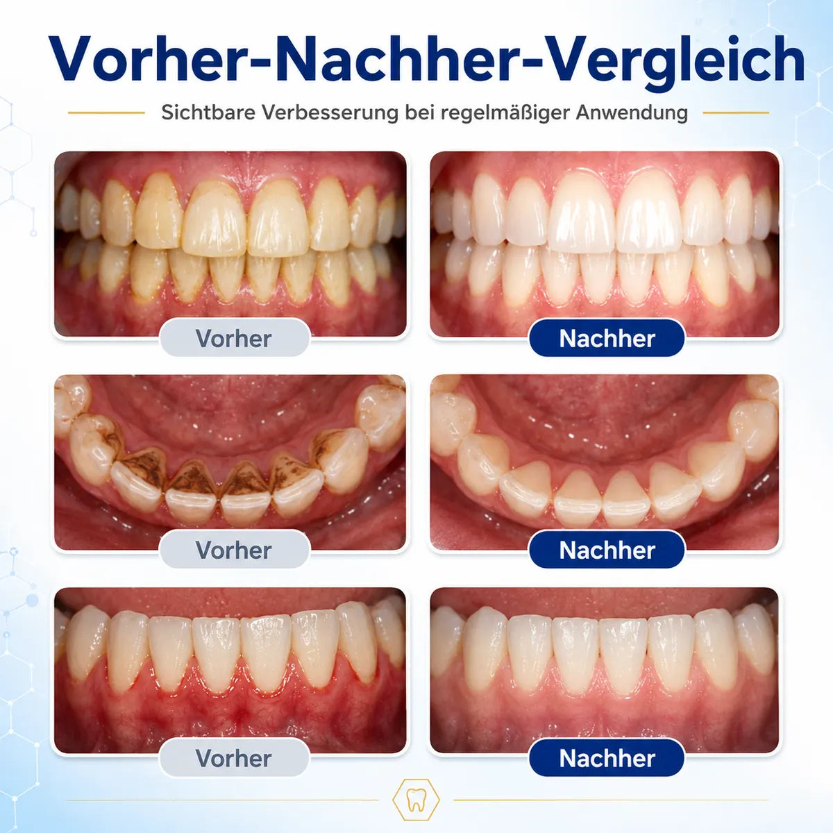 🪄drilena® Reparierende Mundpflege-Lösung mit Bienengift — Konzentriertes Mundwasser für frischen Atem & Anti-Plaque-Schutz