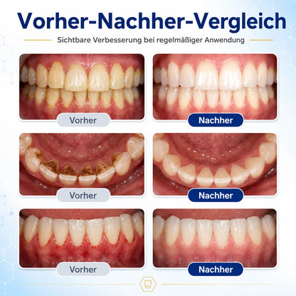 🪄drilena® Reparierende Mundpflege-Lösung mit Bienengift — Konzentriertes Mundwasser für frischen Atem & Anti-Plaque-Schutz
