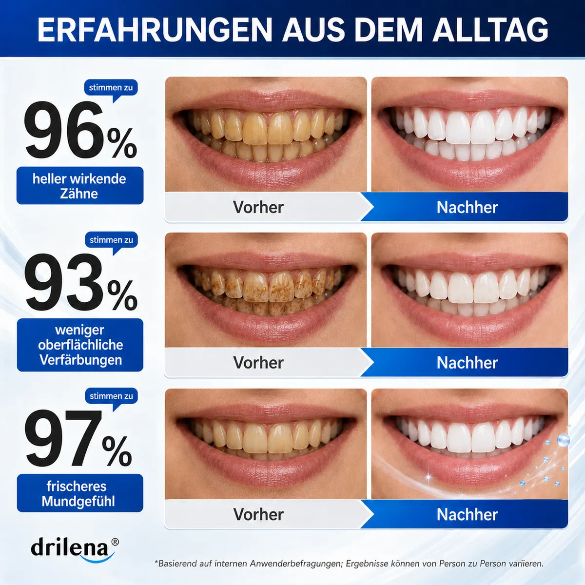 🫧🪄Bestseller – Hydroxylapatit-Zahnpasta 7,5 % zur Zahnschmelz-Reparatur & Zahnaufhellung – Frischer Geschmack, fluoridfrei (Copy)