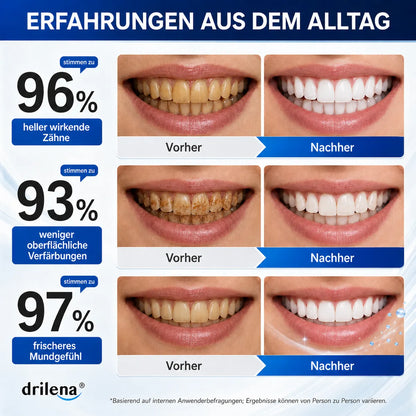 🫧🪄Bestseller – Hydroxylapatit-Zahnpasta 7,5 % zur Zahnschmelz-Reparatur & Zahnaufhellung – Frischer Geschmack, fluoridfrei (Copy)