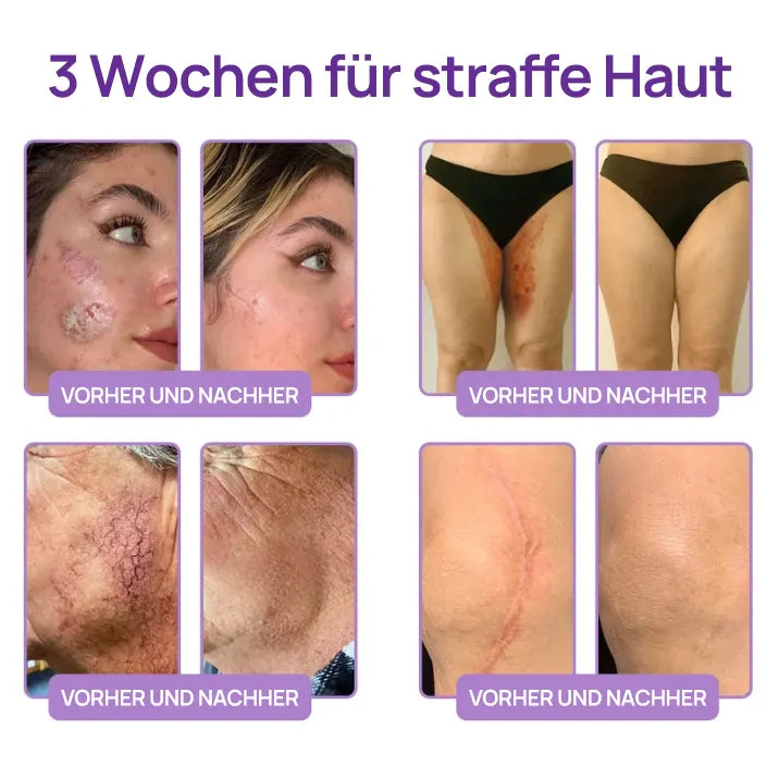 🪄drilena® Straffende Hals- & Dekolleté-Roll-On-Creme