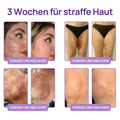 🪄drilena® Straffende Hals- & Dekolleté-Roll-On-Creme