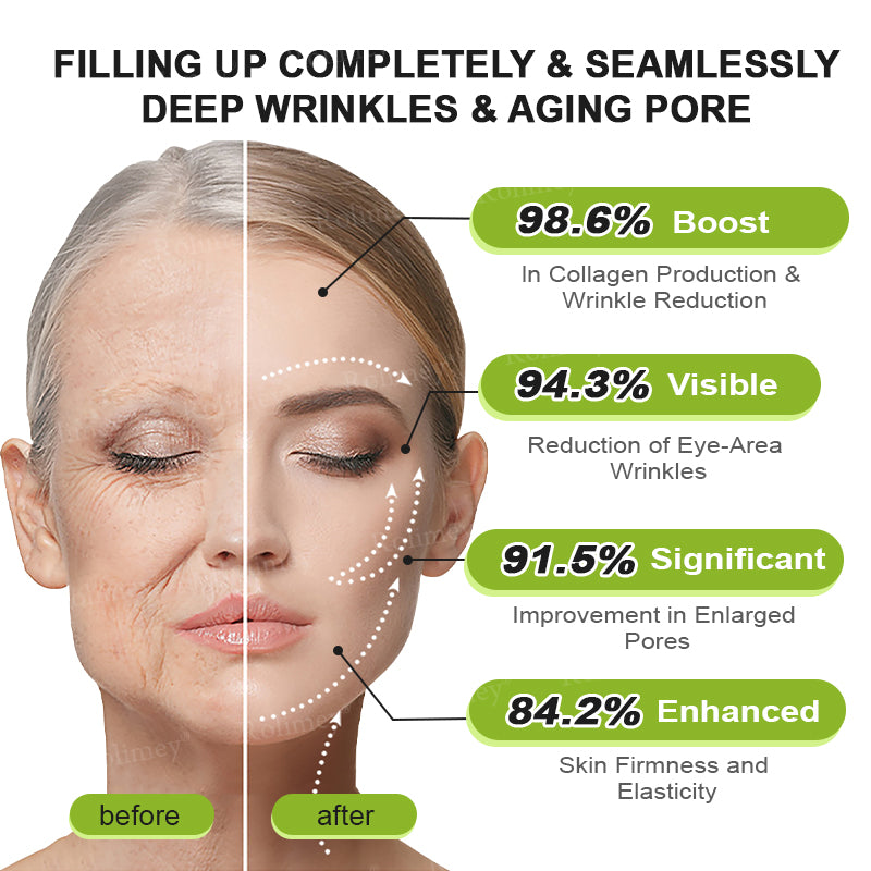 🧡Enjoy 30% OFF for adding the second one - Rolimey® Botox 🫶