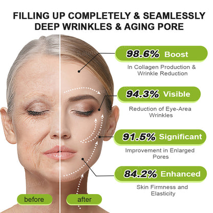🧡Enjoy 30% OFF for adding the second one - Rolimey® Botox 🫶