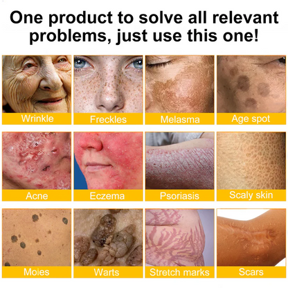 💎FDA Approved: Rolimey® Bee venom Pro Comprehensive Cream — 🔥
