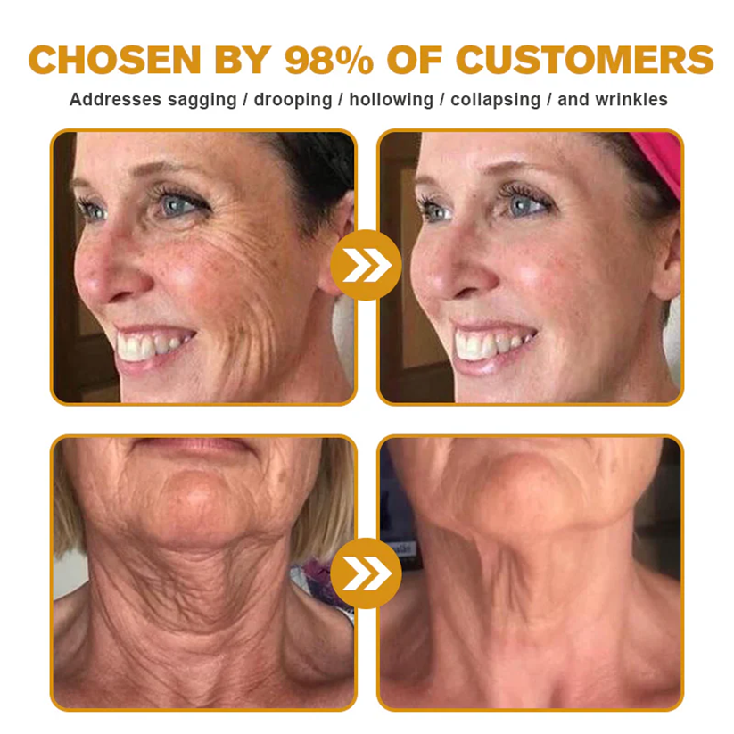 💎FDA Approved: Rolimey® Bee venom Pro Comprehensive Cream — 🔥