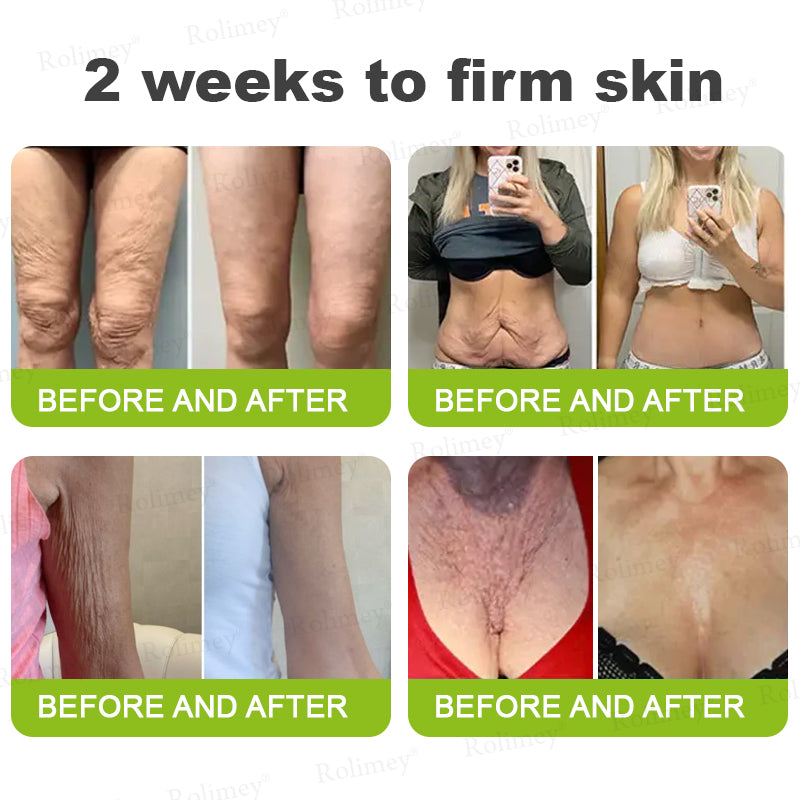 💧Made and shipped from the IE🧑‍⚕️💫Rolimey® Botox & Vita-A Retinol Shot Wrinkle-Lift Tightening cream - Last Day Promotion 70% OFF