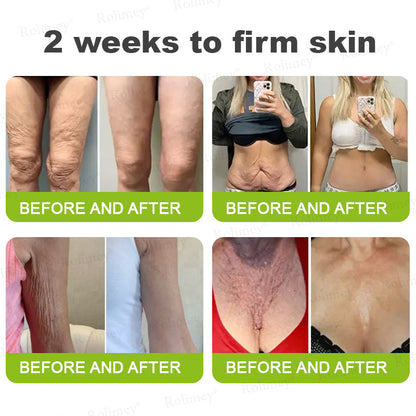 💧Made and shipped from the IE🧑‍⚕️💫Rolimey® Botox & Vita-A Retinol Shot Wrinkle-Lift Tightening cream - Last Day Promotion 70% OFF