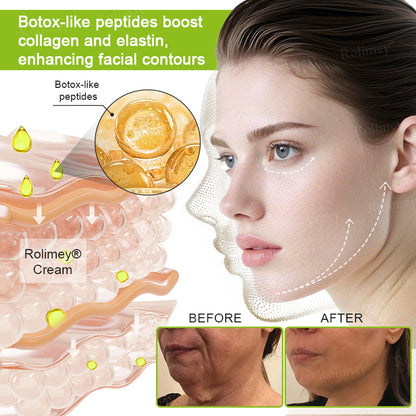 💧Made and shipped from the IE🧑‍⚕️💫Rolimey® Botox & Vita-A Retinol Shot Wrinkle-Lift Tightening cream - Last Day Promotion 70% OFF