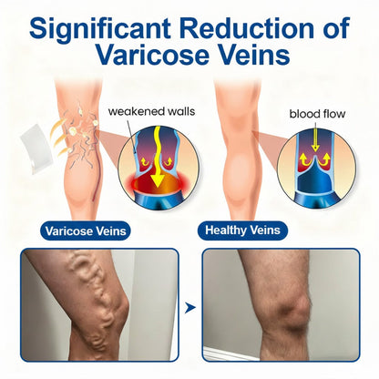 🇮🇪👨‍⚕️❄️GFOUK® VeinEase Microneedle Care Patch⚡Instant Relief, Long-Term Results