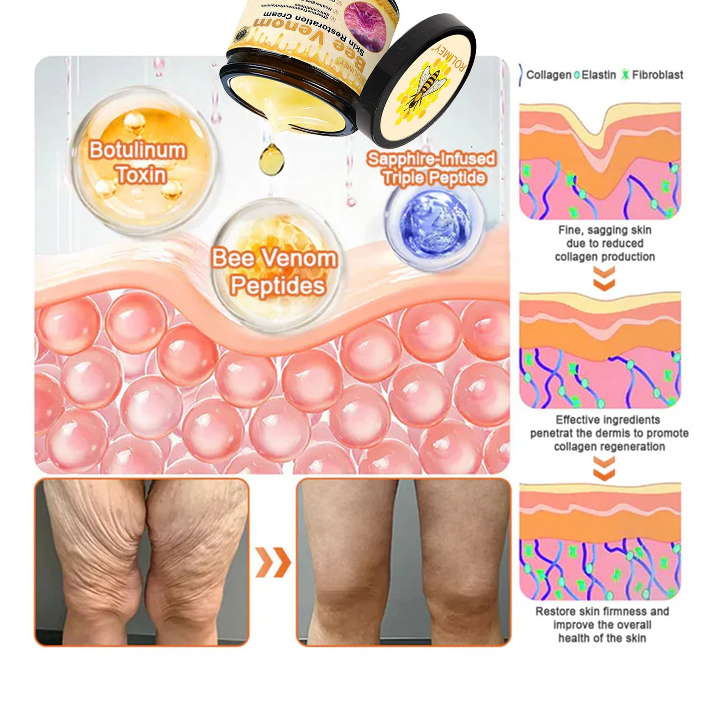 💎FDA Approved: Rolimey® Bee venom Pro Comprehensive Cream — 🔥
