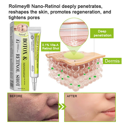 💧Made and shipped from the IE🧑‍⚕️💫Rolimey® Botox & Vita-A Retinol Shot Wrinkle-Lift Tightening cream - Last Day Promotion 70% OFF