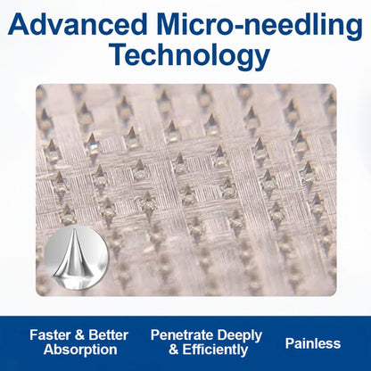 🇮🇪👨‍⚕️❄️GFOUK® VeinEase Microneedle Care Patch⚡Instant Relief, Long-Term Results