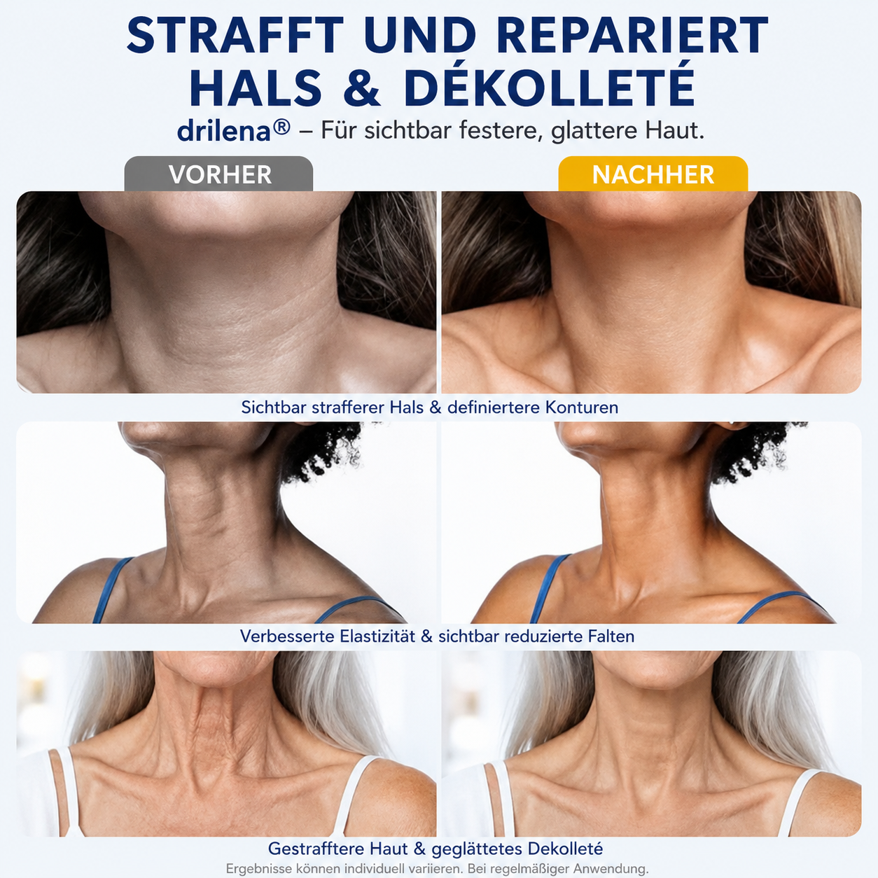 👩 drilena® Straffende Hals- & Dekolleté-Roll-On-Creme
