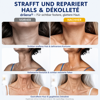 👩 drilena® Straffende Hals- & Dekolleté-Roll-On-Creme