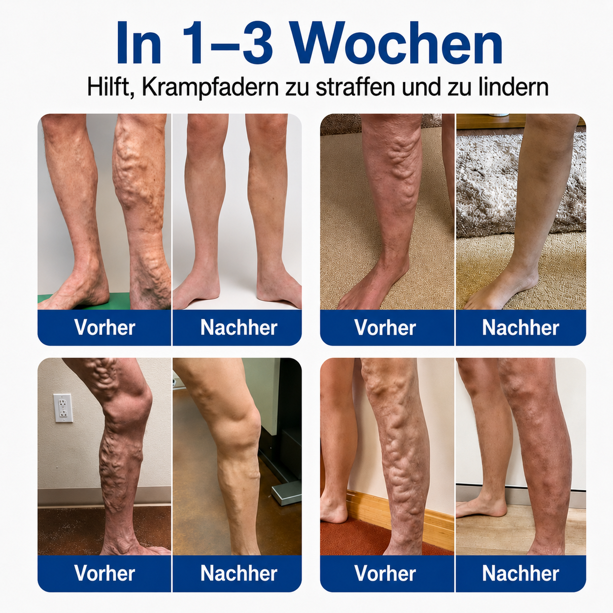 🧙 drilena® VeinTarget – Mikronadelpflaster ⚡ Sofortige Linderung, langanhaltende Ergebnisse