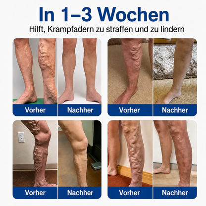 🧙 drilena® VeinTarget – Mikronadelpflaster ⚡ Sofortige Linderung, langanhaltende Ergebnisse