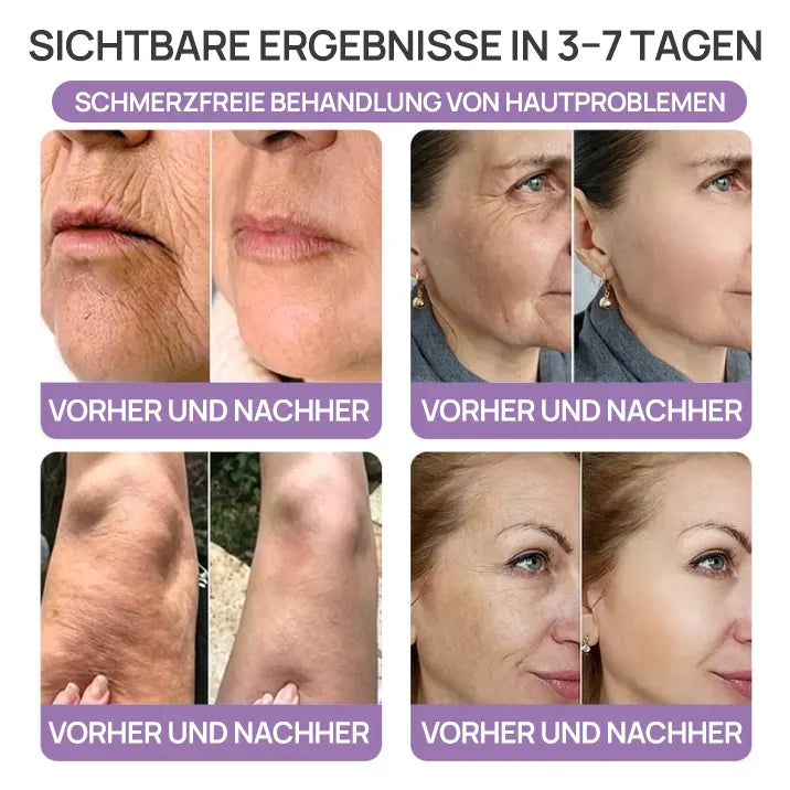 🪄drilena® Straffende Hals- & Dekolleté-Roll-On-Creme