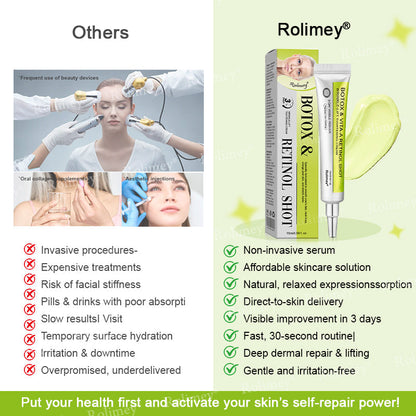 💧Made and shipped from the IE🧑‍⚕️💫Rolimey® Botox & Vita-A Retinol Shot Wrinkle-Lift Tightening cream - Last Day Promotion 70% OFF