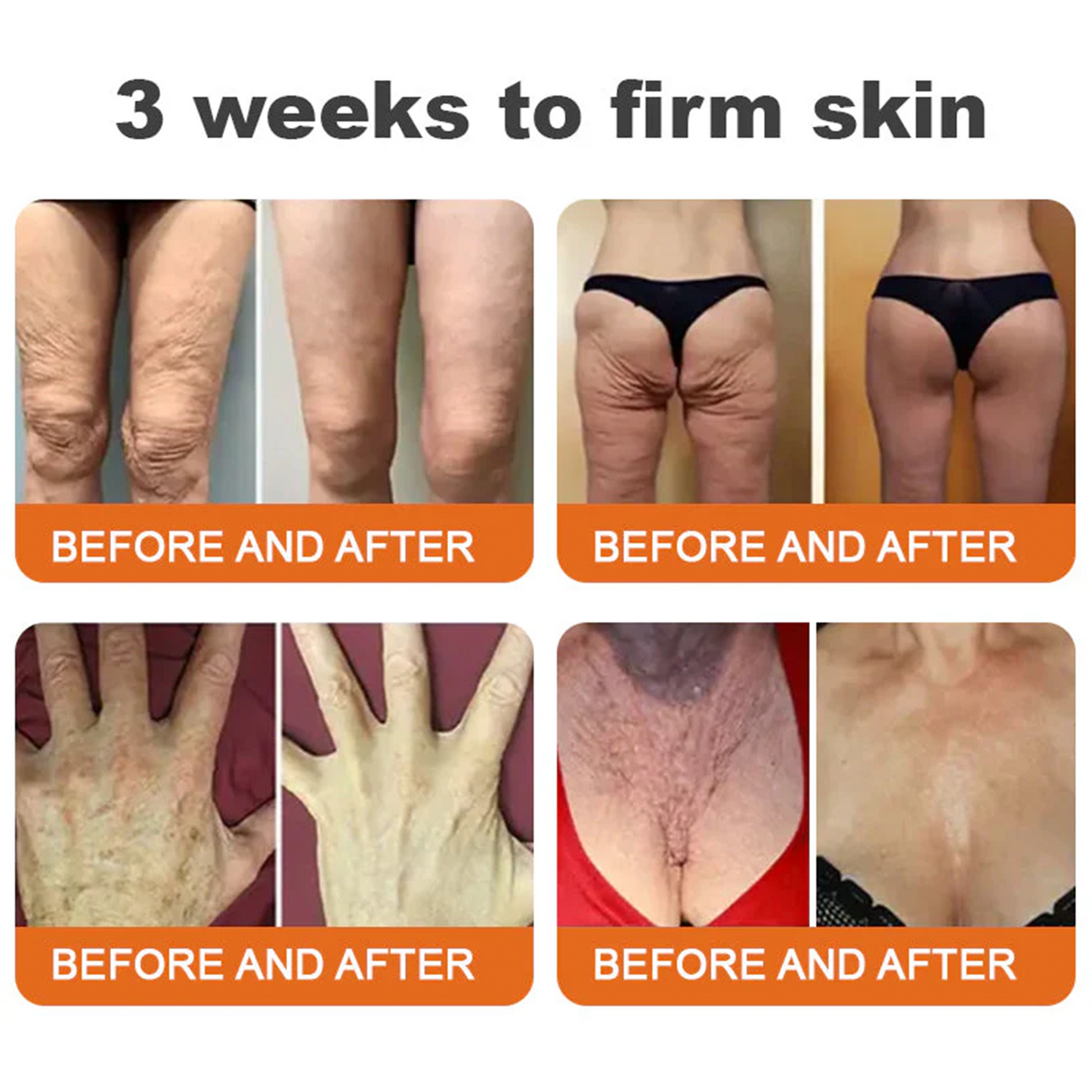 👨‍⚕️🔥Dermatologist Recommended👨‍⚕️: Rolimey® Bee Venom Advanced Skin Rescue — Specifically Formulated for Paper-Thin, Fragile & Easy-Bruising Skin — 🔥Limited Time 80% OFF🔥
