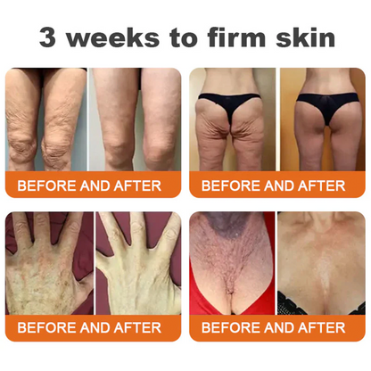 👨‍⚕️🔥Dermatologist Recommended👨‍⚕️: Rolimey® Bee Venom Advanced Skin Rescue — Specifically Formulated for Paper-Thin, Fragile & Easy-Bruising Skin — 🔥Limited Time 80% OFF🔥