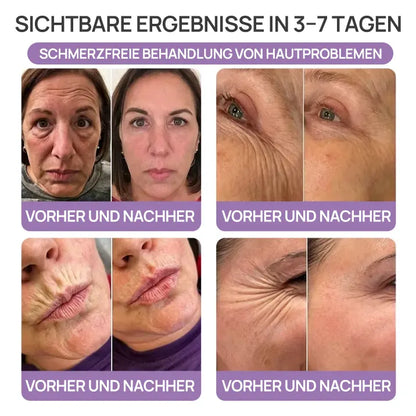 🪄drilena® Straffende Hals- & Dekolleté-Roll-On-Creme