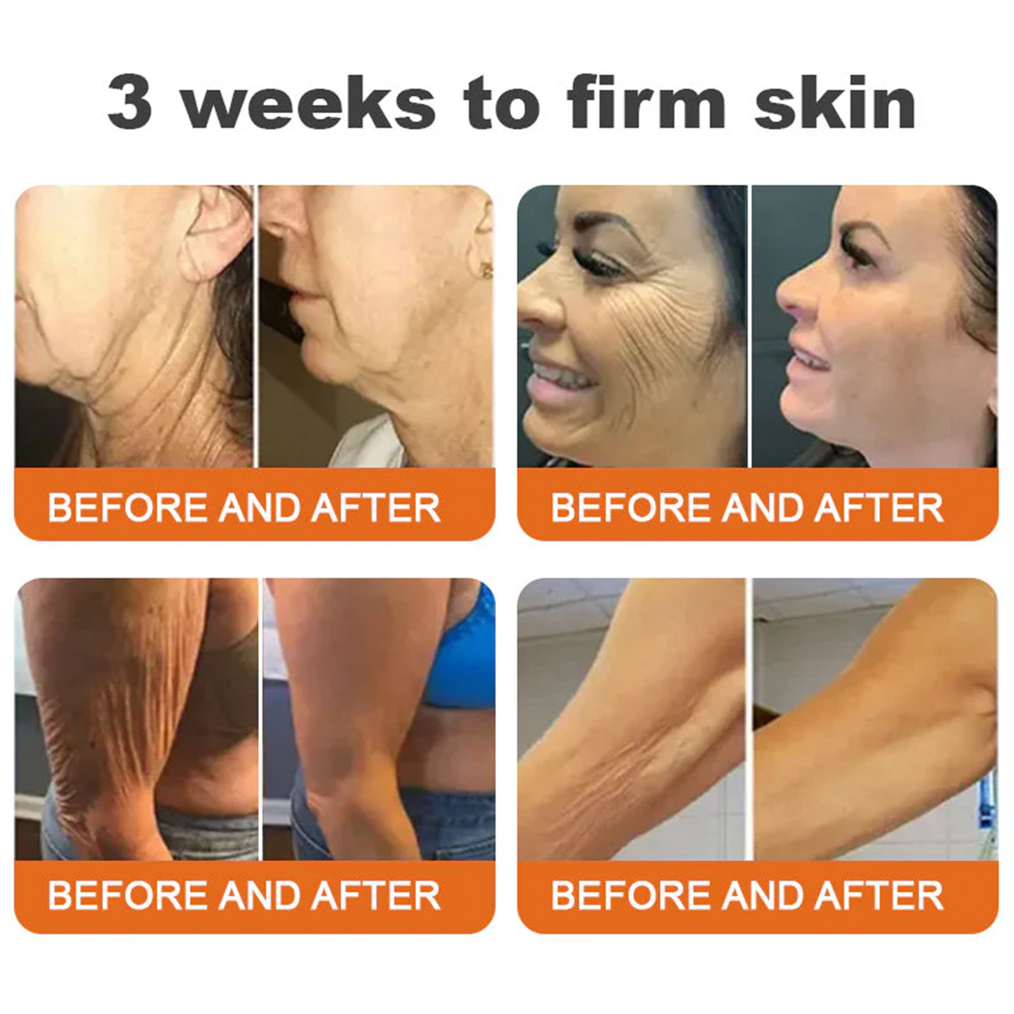 💎FDA Approved: Rolimey® Bee venom Pro Comprehensive Cream — 🔥