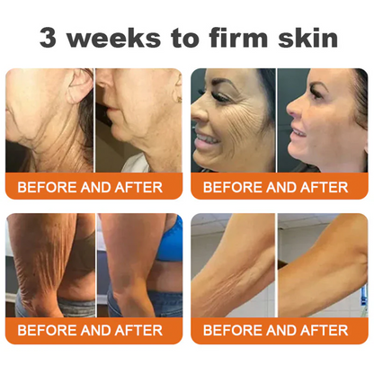 👨‍⚕️🔥Dermatologist Recommended👨‍⚕️: Rolimey® Bee Venom Advanced Skin Rescue — Specifically Formulated for Paper-Thin, Fragile & Easy-Bruising Skin — 🔥Limited Time 80% OFF🔥