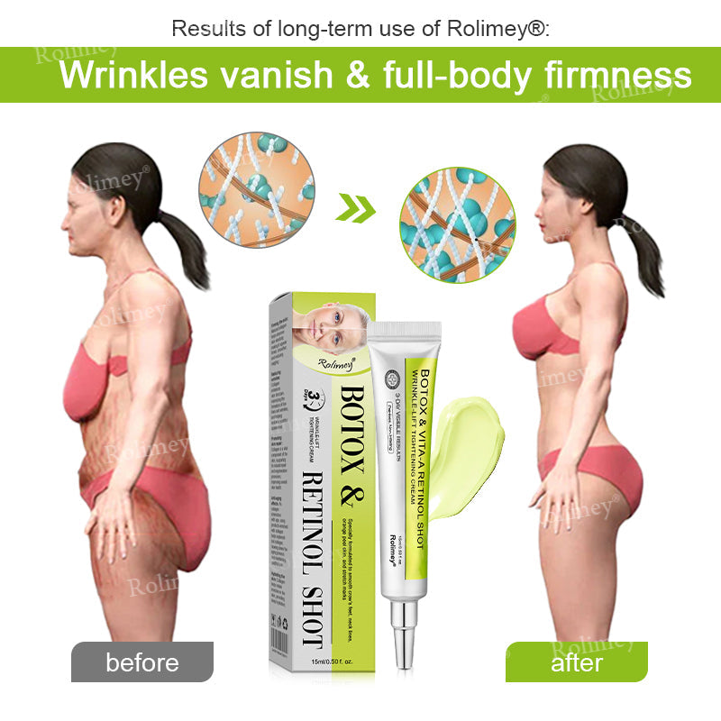 💧Made and shipped from the IE🧑‍⚕️💫Rolimey® Botox & Vita-A Retinol Shot Wrinkle-Lift Tightening cream - Last Day Promotion 70% OFF