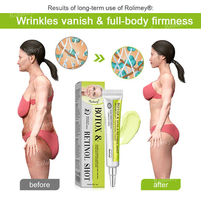 💧Made and shipped from the IE🧑‍⚕️💫Rolimey® Botox & Vita-A Retinol Shot Wrinkle-Lift Tightening cream - Last Day Promotion 70% OFF