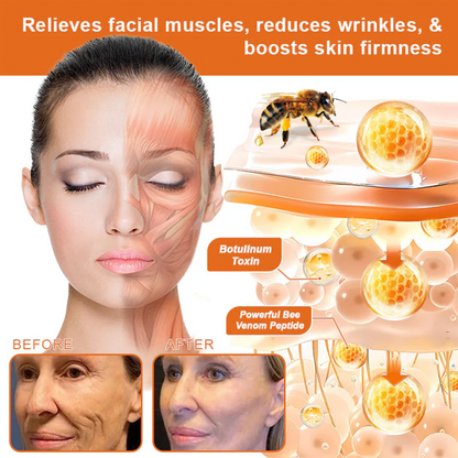 👨‍⚕️🔥Dermatologist Recommended👨‍⚕️: Rolimey® Bee Venom Advanced Skin Rescue — Specifically Formulated for Paper-Thin, Fragile & Easy-Bruising Skin — 🔥Limited Time 80% OFF🔥