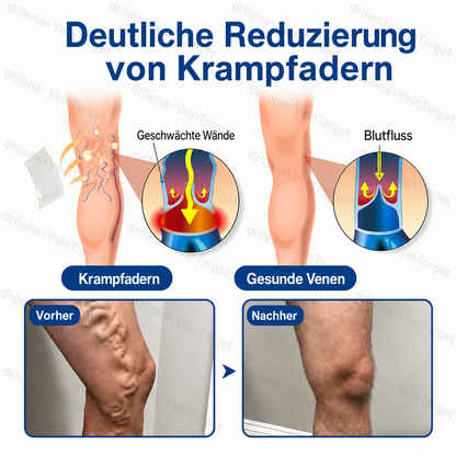 🧙 drilena® VeinTarget – Mikronadelpflaster ⚡ Sofortige Linderung, langanhaltende Ergebnisse