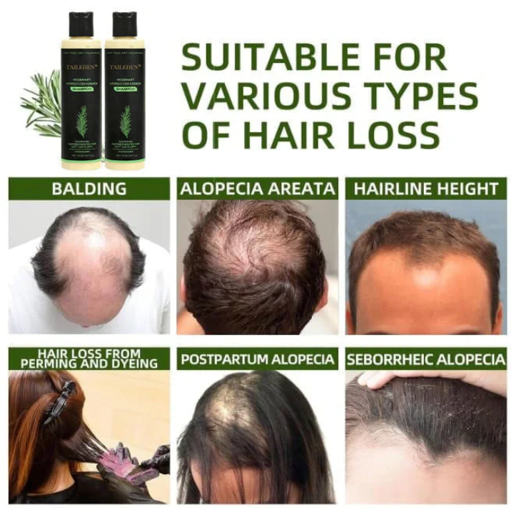 🔥 LETZTER TAG: 50 % RABATT – 🎅 Bio-Rosmarin-Shampoo für Haarwachstum