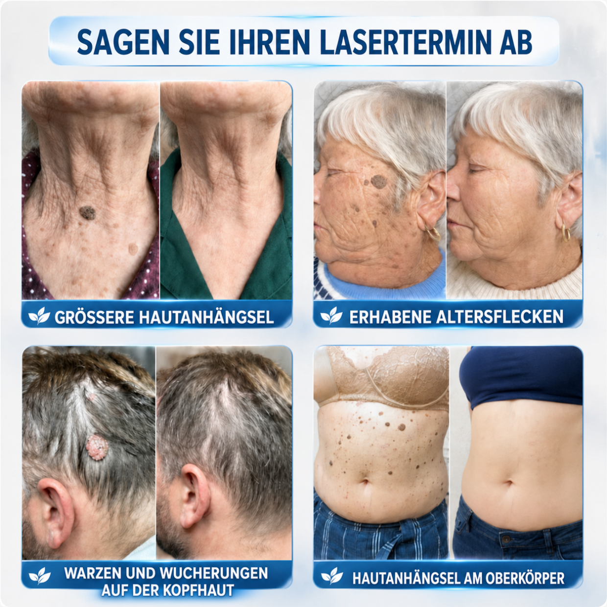 🛒drilena®7-Tage Hautanhängsel- & Fleckenentferner – schmerzfrei & narbenfrei Fortschrittlicher Roll-on-Stift zur Entfernung von Hautunreinheiten