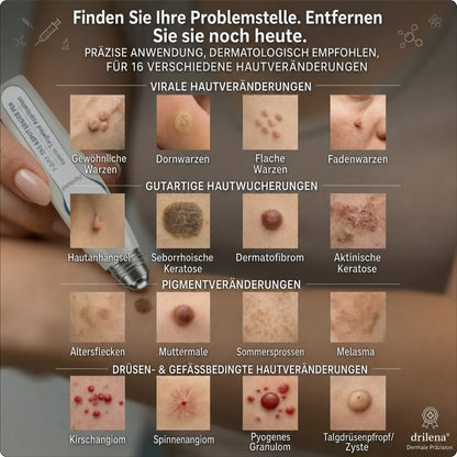 🛒drilena®7-Tage Hautanhängsel- & Fleckenentferner – schmerzfrei & narbenfrei Fortschrittlicher Roll-on-Stift zur Entfernung von Hautunreinheiten