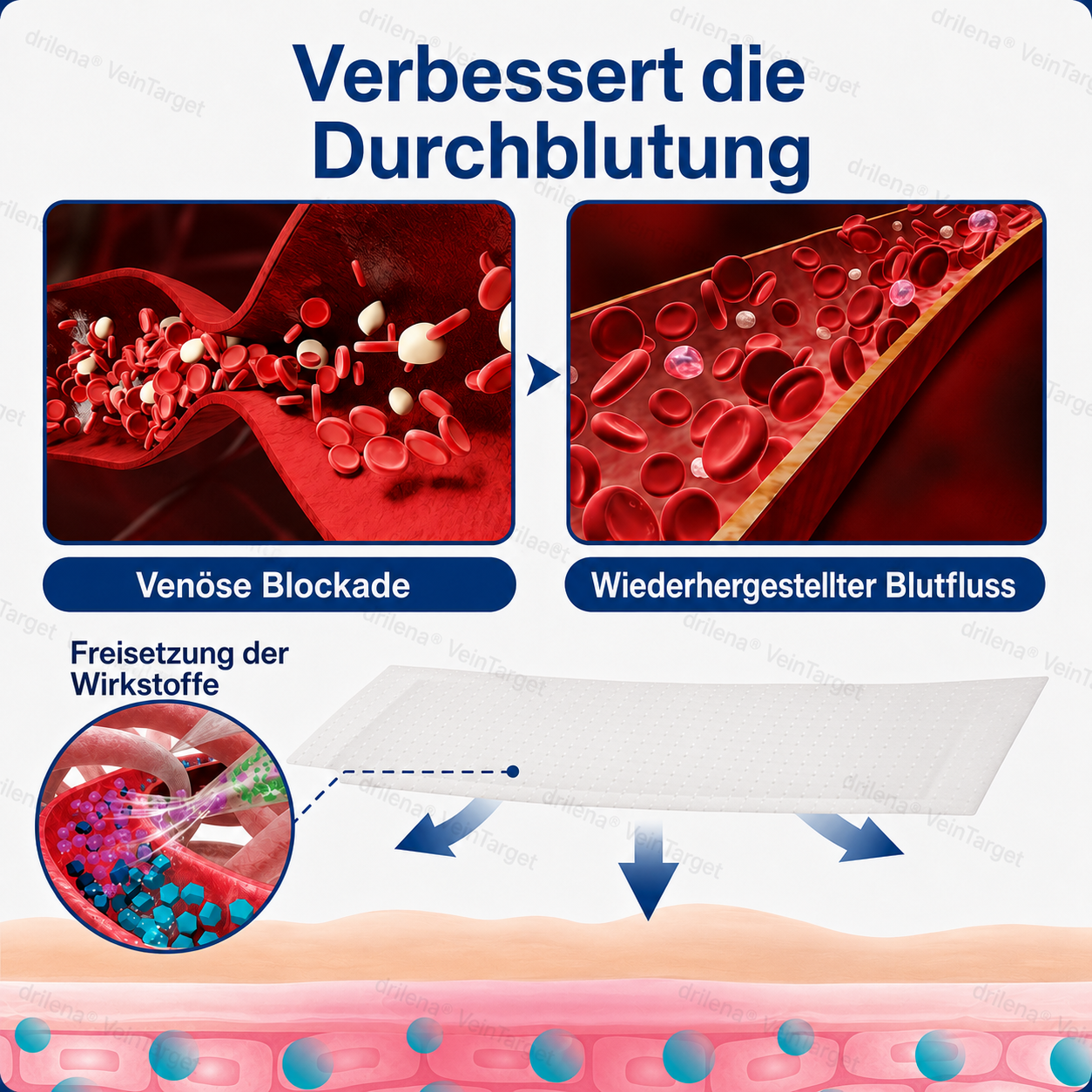 🧙 drilena® VeinTarget – Mikronadelpflaster ⚡ Sofortige Linderung, langanhaltende Ergebnisse