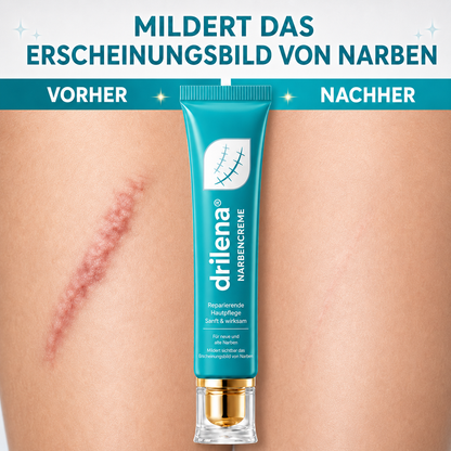 🆙drilena® Reparierende Anti-Narben-Creme — Dehnungsstreifen, Narben & Aknemale