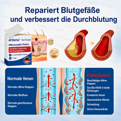 🧙 drilena® VeinTarget – Mikronadelpflaster ⚡ Sofortige Linderung, langanhaltende Ergebnisse