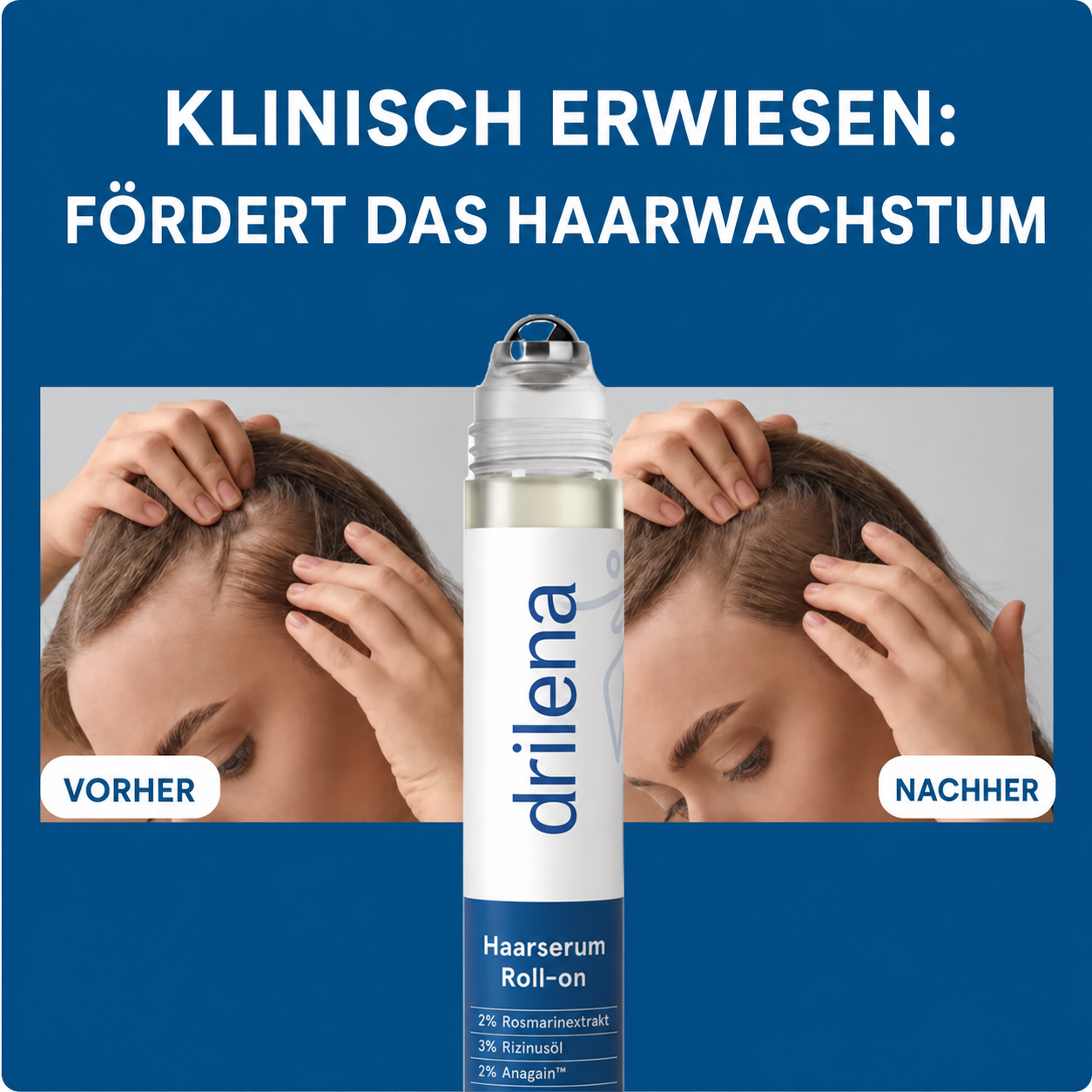 🪮drilena® Hair Growth Roll on Serum